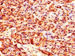 CARS Antibody in Immunohistochemistry (Paraffin) (IHC (P))