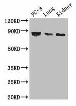 CARS Antibody in Western Blot (WB)