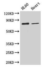 Calpastatin Antibody in Western Blot (WB)