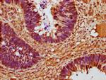 Cyclin D2 Antibody in Immunohistochemistry (Paraffin) (IHC (P))