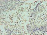 Cyclin D2 Antibody in Immunohistochemistry (Paraffin) (IHC (P))