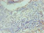 Cyclin D2 Antibody in Immunohistochemistry (Paraffin) (IHC (P))