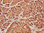 Cyclin D2 Antibody in Immunohistochemistry (Paraffin) (IHC (P))