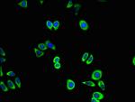 CDK5 Antibody in Immunocytochemistry (ICC/IF)