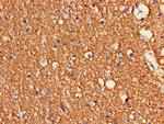 CDK5 Antibody in Immunohistochemistry (Paraffin) (IHC (P))