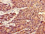 CDK5 Antibody in Immunohistochemistry (Paraffin) (IHC (P))