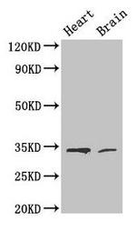 CDK5 Antibody in Western Blot (WB)