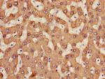 CES1 Antibody in Immunohistochemistry (Paraffin) (IHC (P))