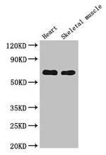 CES1 Antibody in Western Blot (WB)