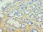 Complement Factor H Antibody in Immunohistochemistry (Paraffin) (IHC (P))