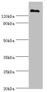 Complement Factor H Antibody in Western Blot (WB)