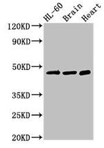 CHST1 Antibody in Western Blot (WB)