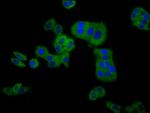 CLCNKB Antibody in Immunocytochemistry (ICC/IF)