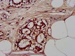 CLCNKB Antibody in Immunohistochemistry (Paraffin) (IHC (P))