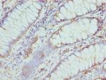 CMPK1 Antibody in Immunohistochemistry (Paraffin) (IHC (P))