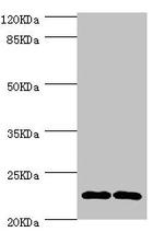 CMPK1 Antibody in Western Blot (WB)