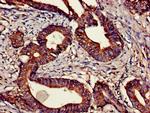 CNTFR Antibody in Immunohistochemistry (Paraffin) (IHC (P))