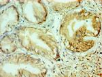 Collagen X Antibody in Immunohistochemistry (Paraffin) (IHC (P))