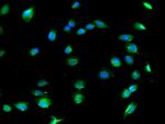 COL8A1 Antibody in Immunocytochemistry (ICC/IF)