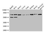 COL8A1 Antibody in Western Blot (WB)