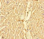 CPT1A Antibody in Immunohistochemistry (Paraffin) (IHC (P))