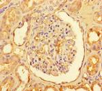 CPT1A Antibody in Immunohistochemistry (Paraffin) (IHC (P))