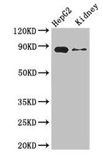 CPT1A Antibody in Western Blot (WB)