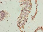 CRABP1 Antibody in Immunohistochemistry (Paraffin) (IHC (P))