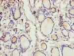 CRABP1 Antibody in Immunohistochemistry (Paraffin) (IHC (P))