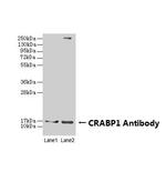 CRABP1 Antibody in Western Blot (WB)