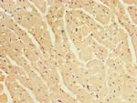 CRYBA1 Antibody in Immunohistochemistry (Paraffin) (IHC (P))