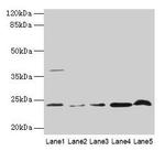 CRYBA1 Antibody in Western Blot (WB)