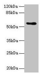 CSAD Antibody in Western Blot (WB)