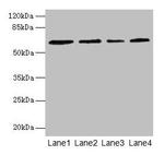 CSGALNACT2 Antibody in Western Blot (WB)