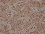 CSK Antibody in Immunohistochemistry (Paraffin) (IHC (P))