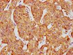 CK1 delta Antibody in Immunohistochemistry (Paraffin) (IHC (P))