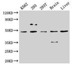 CK1 delta Antibody in Western Blot (WB)