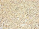 CTPS Antibody in Immunohistochemistry (Paraffin) (IHC (P))