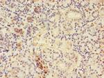 CTPS Antibody in Immunohistochemistry (Paraffin) (IHC (P))