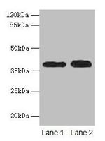 Cathepsin L Antibody in Western Blot (WB)