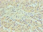 CYP11A1 Antibody in Immunohistochemistry (Paraffin) (IHC (P))