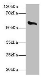 CYP11A1 Antibody in Western Blot (WB)