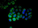 CYP17A1 Antibody in Immunocytochemistry (ICC/IF)