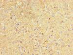 CYP17A1 Antibody in Immunohistochemistry (Paraffin) (IHC (P))