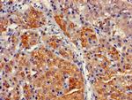 CYP17A1 Antibody in Immunohistochemistry (Paraffin) (IHC (P))