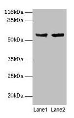 CYP17A1 Antibody in Western Blot (WB)