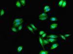 CYSLTR1 Antibody in Immunocytochemistry (ICC/IF)