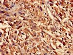 CYSLTR1 Antibody in Immunohistochemistry (Paraffin) (IHC (P))