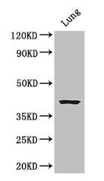 CYSLTR1 Antibody in Western Blot (WB)