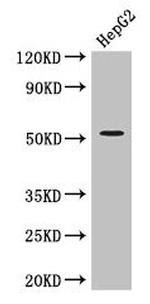 ZIPK Antibody in Western Blot (WB)